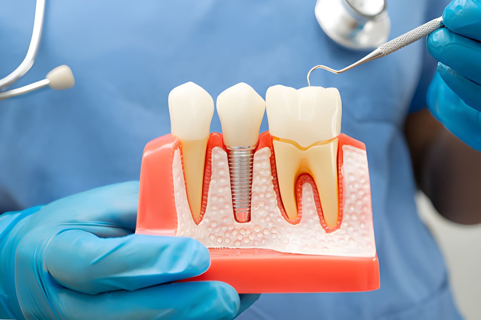 how to care for dental implants.