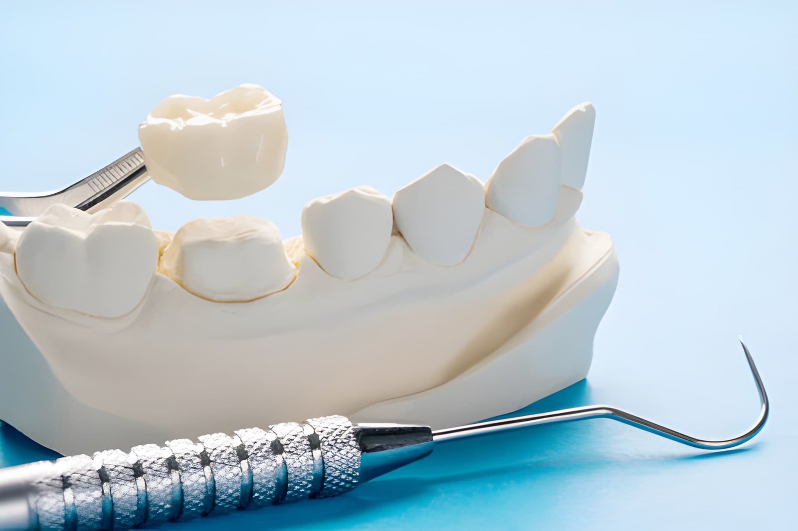 types of dental crowns.